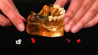 Straumann Tissue Level Impression Taking Components [upl. by Naejeillib]