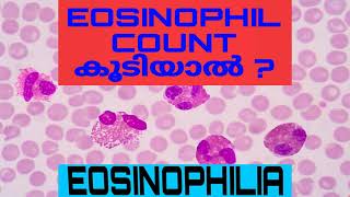 Eosinophilia  Absolute Eosinophil Count AEC Malayalam [upl. by Zere]