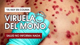 Hay casos en varios municipios del estado la autoridad calla a pesar del riesgo de infección [upl. by Cruickshank]