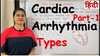 Cardiac Arrhythmia  Part1  Types of Cardiac Arrhythmia  RajNEET Medical Education [upl. by Nawotna189]