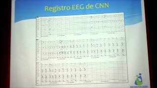 Convulsiones Neonatales Dra MT Henriquez 13112013 [upl. by Alrahs945]