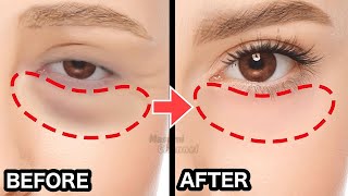 8mins Eye Bags Removal Exercise amp Massage You Must Do  Eye Wrinkles Dark Circles Under Eyes [upl. by Enad345]