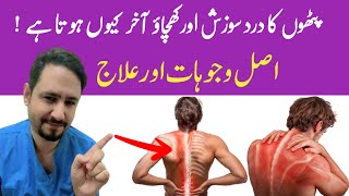 Myalgia Muscle Pain Treatment In Urdu Hindi  Dr Irfan Azeem [upl. by Esinwahs]