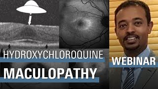 An Objective Method of Diagnosing Hydroxychloroquine Maculopathy [upl. by Atekehs]