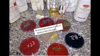 All essential culture media of Medical Microbiology Practical demo from a single table [upl. by Udell]