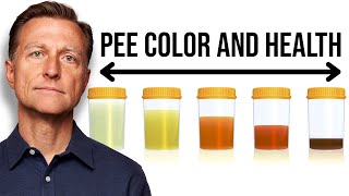 What Your URINE COLOR Says about Your Health [upl. by Auqinat]