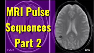 How to Understanding MRI Pulse Sequence Part 1 [upl. by Irving]