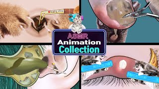 ASMR Removal of navel stones ingrown toenails ear cleaning eye stye treatment animation asmr [upl. by Line]