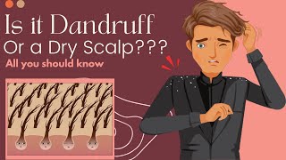 Is It Dandruff Or A Dry Scalp Heres What You Need To Know [upl. by Ahsimin365]