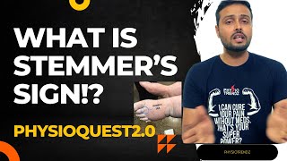 What is Stemmers sign and How to Test it  PHYSIOQUEST 20 [upl. by Elyac]