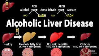 Alcoholic Liver Disease Animation [upl. by Revell]