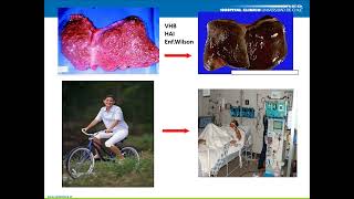 GASTROENTEROLOGÍA 8 Hepatitis fulminante [upl. by Vaasta]