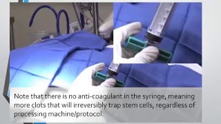 Things not to do in a Bone Marrow Aspiration [upl. by Ostler]