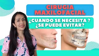 Cirugia Maxilofacial ¿cuando se necesita [upl. by Euqirne]