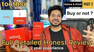 Toothsi aligners Full Honest Review in details  2 year experience part2 [upl. by Durkin269]