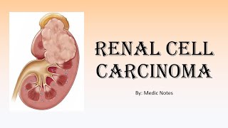 Renal cell carcinoma kidney cancer  signs and symptoms TNM staging investigation treatment [upl. by Trebornhoj]