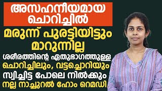 ശരീരത്തിന്റെ ഏതുഭാഗത്തുള്ള ചൊറിച്ചിലും വട്ടച്ചൊറിയും മാറാൻ നല്ല നാച്ചുറൽ ഹോം റെമഡിvattachori maran [upl. by Obmar471]