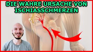 Die WAHRE Ursache von ISCHIASSCHMERZEN IschiasSyndrom  Wenn das Fundament wackelt [upl. by Derfniw454]