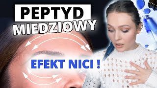 PEPTYDY MIEDZIOWE  SILNIEJSZE od Tretynoiny  kolagen 😱 jak używać POPRAWNIE 👆🏻 [upl. by Arotak]