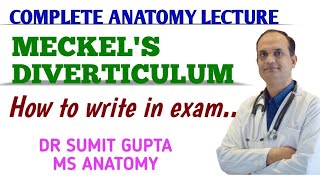 Meckels Diverticulum  Anatomy [upl. by Aikemaj]