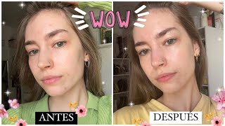 MI SKINCARE contra EL ACNÉ 🧖🏼‍♀️❌  Acnemy  Mayiyi ♡ [upl. by Adekahs]