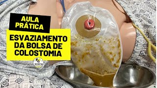 Esvaziamento da bolsa de Colostomia [upl. by Wein]