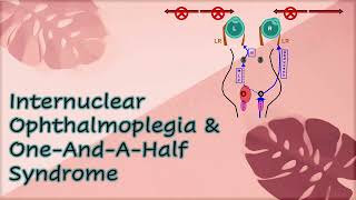 Internuclear Ophthalmoplegia amp One And A Half Syndrome [upl. by Dabbs]