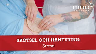 Skötsel och hantering  Stomi [upl. by Niroht]