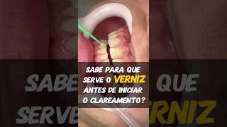 Verniz para clareamento dental [upl. by Slerahc800]