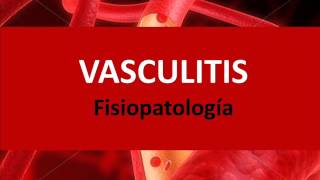 Vasculitis  Fisiopatología [upl. by Chard]