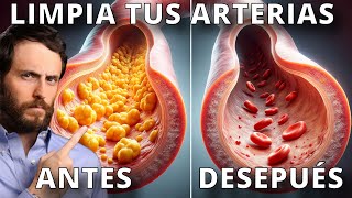 Haz Esto para Destapar tus Arterias y Corregir tu Colesterol [upl. by Aidualc]