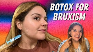 I Got Masseter Botox for Bruxism My Experience Cost Results and Side Effects  Under Eye Botox [upl. by Coltson767]