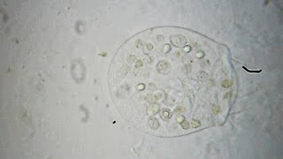 Vorticella  Pseudovorticella [upl. by Sidnarb]