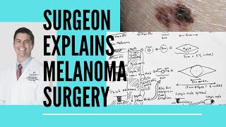 Surgeon explains melanoma surgery [upl. by Crandall99]