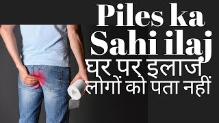 Piles treatment at home in Hindi  Bavasir ka ilaj [upl. by Hodgson]