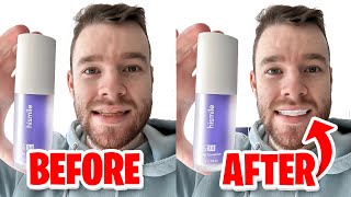 HiSmile v34 Colour Corrector  Get White Teeth Easy  Honest Review [upl. by Agrippina]