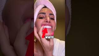 How To Whiten Your Teeth At Home 😧 [upl. by Phil]