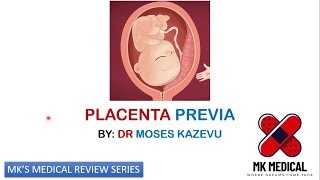 Placenta previa [upl. by Seugram]