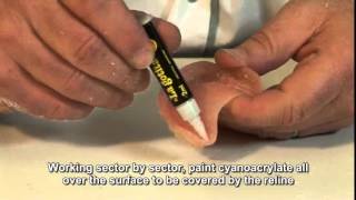 Deflex flexible dentures Video 9 Relines with acrylic [upl. by Osugi192]