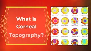 What is Corneal Topography [upl. by Asille]