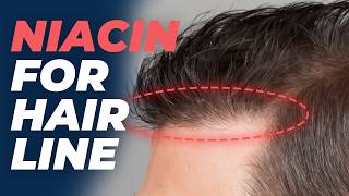 NIACIN for Hair Growth  How Well Does it Work [upl. by Udell727]