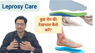 Leprosy Care  कुष्ट रोग की देखभाल  leprosy disease in hindi  kust rog ki dawa  kust rog kya hai [upl. by Ahsykal]