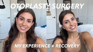 Otoplasty Surgery My experience before  after healing  recovery [upl. by Bohannon]