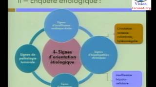 Conduite à Tenir devant une Ascite Abdominale Cas Clinique physiopathologie Symptomes [upl. by Htide]