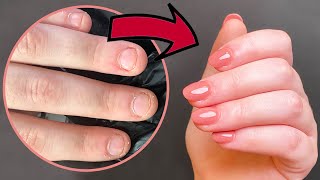 TUTO EXTENSIONS CHABLON SUR ONGLES RONGÉS [upl. by Oric]