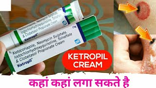 Ketoconazole Neomycin Iodochlorhydroxyquinoline Tolnaftate amp Clobetasol Propionate Cream Ketropil [upl. by Alethia439]