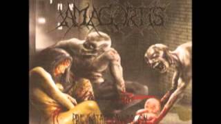 Amagortis  PreNatal Canibalism 2008 Full Album [upl. by Haila]