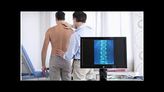 ¿Qué es un angioma vertebral causas síntomas y tratamiento  Mejor con Salud [upl. by Hoj]