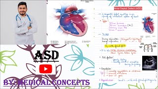 Atrial Septal Defect ASD  CHD  Paediatrics [upl. by Hartmunn]