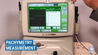 NIDEK US4000500 Ultrasound  Pachymetry Overview [upl. by Krutz]